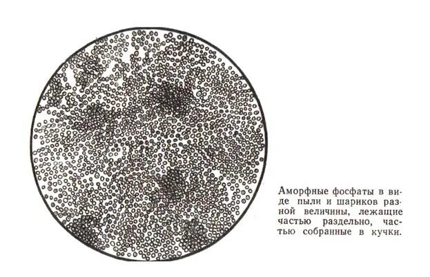 Фосфаты в моче у мужчин. Аморфные фосфаты микроскопия. Аморфные фосфаты микроскопия мочи. Аморфные фосфаты под микроскопом. Кристаллы аморфных фосфатов в моче.