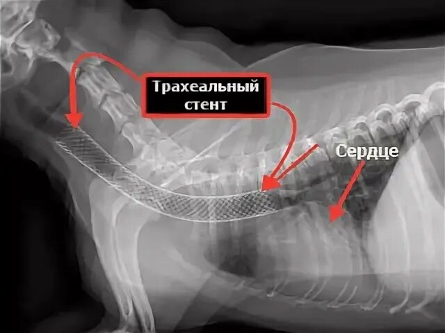 Стеноз у собак. Стентирование трахеи у собак. Коллапс трахеи у собак стентирование. Коллапс трахеи рентген. Коллапс трахеи у собак рентген.