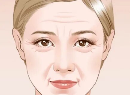 Expression lines
