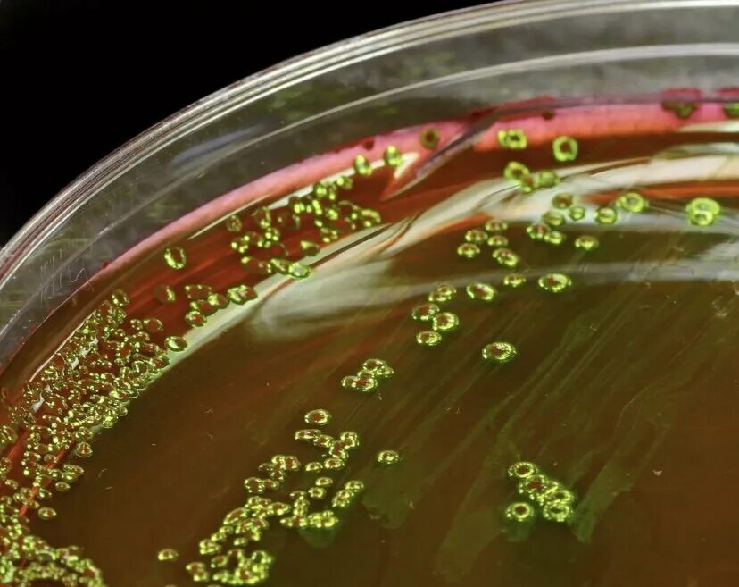 Pseudomonas aeruginosa мясопептонный бульон. Pseudomonas aeruginosa на чашке Петри. Кишечная палочка на Эндо. Мясопептонный агар эшерихии. Бактерии неприятный запах