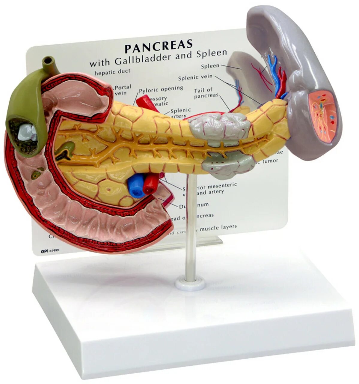 Pancreas atis. Поджелудочная железа pancreas. Pancreas atis. 12 перстная кишка и поджелудочная железа. The structure of the pancreas.