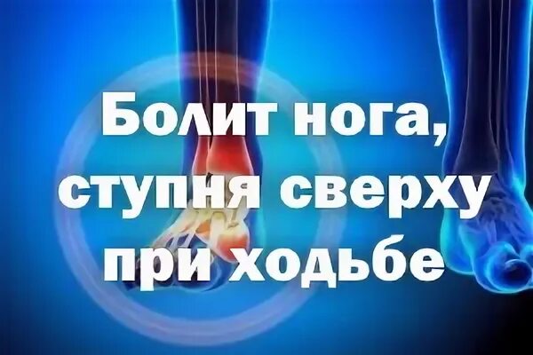 Болит стопа сверху. Болит нога при ходьбе в стопе сверху. болит ступня сверху при ходьбе. болит нога ступня сверху. болит ступня сбоку и сверху.