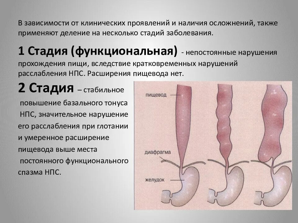 Пищи по пищеводу причины