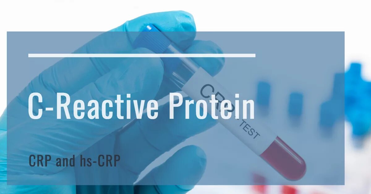 Reactive org. C reactive protein. c-reactive protein test vector. reactive.