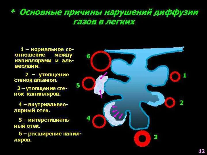 При диффузии газов в легких происходит. Причины нарушений диффузии газов в легких:. Причины и механизмы нарушений диффузии газов в легких. Причины нарушения диффузии газов. Причины нарушения диффузии.