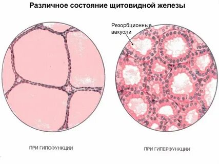 Железа геншин
