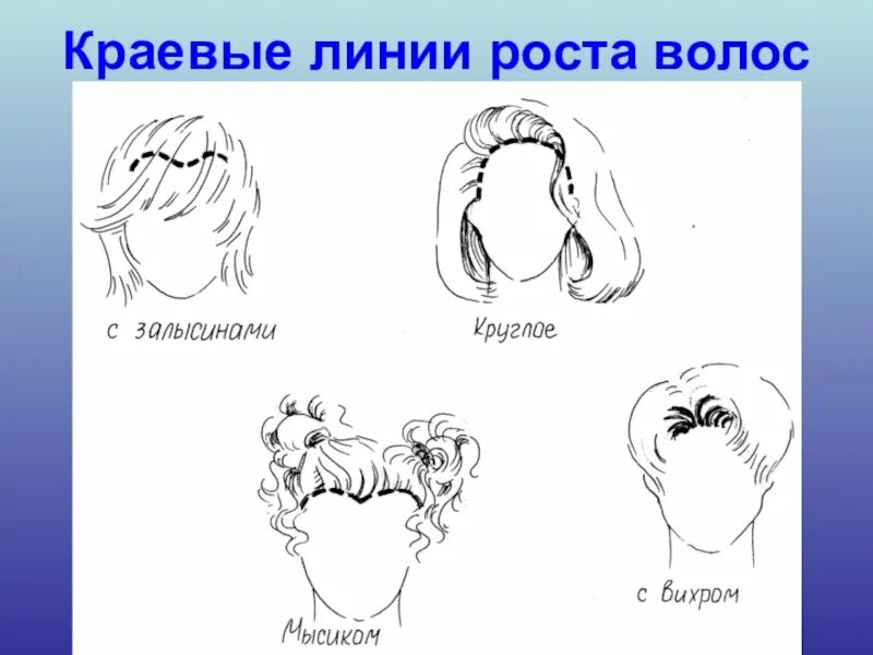 Виды линии роста волос. Линия роста волос. краевая линия роста волос схема. форма роста волос на голове. типы линии роста волос.