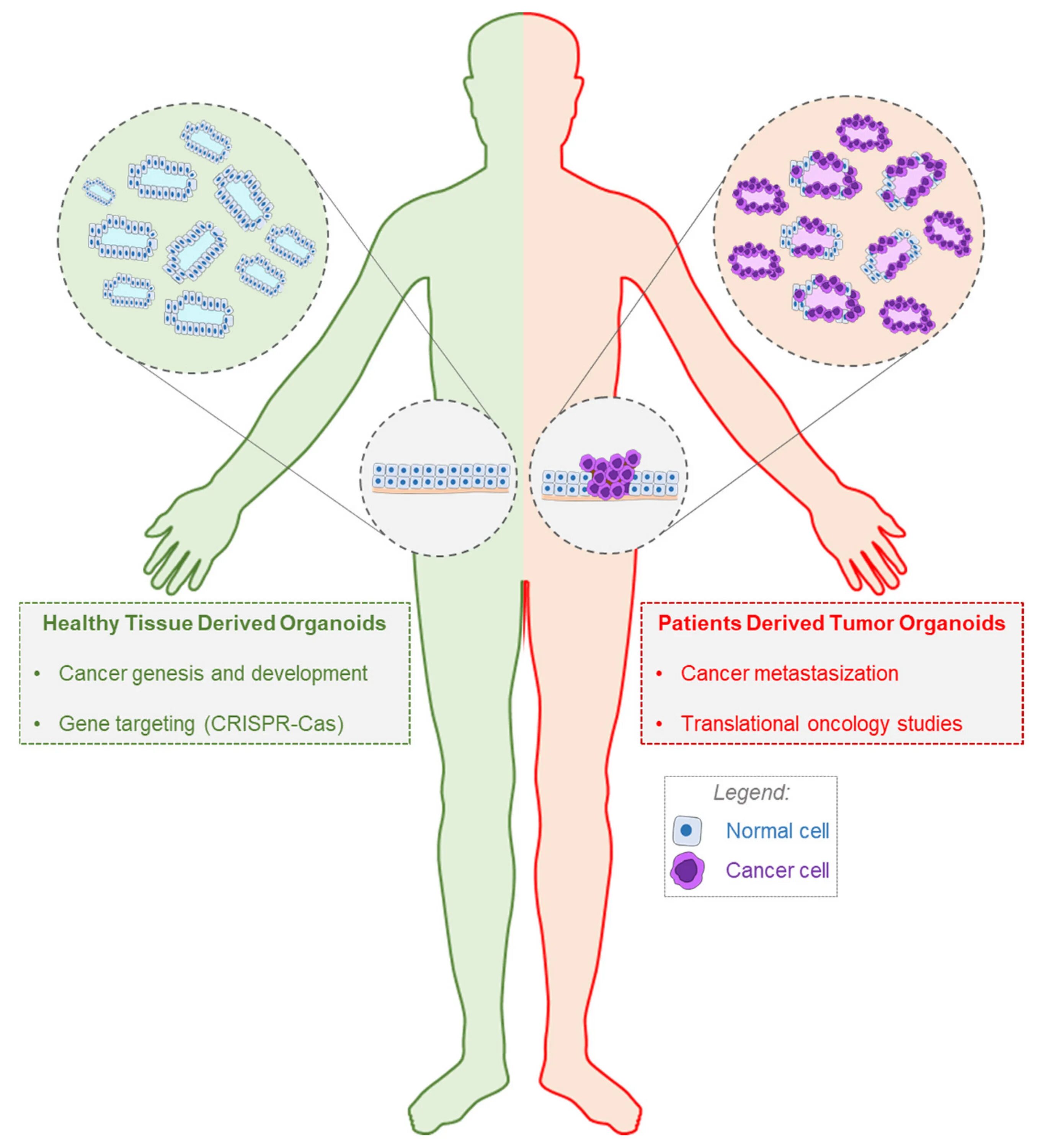 Patient derived xenograft перевод. Induced pluripotent stem cells. Patient derived. Xenograft регистрация. Ксенографты виды.