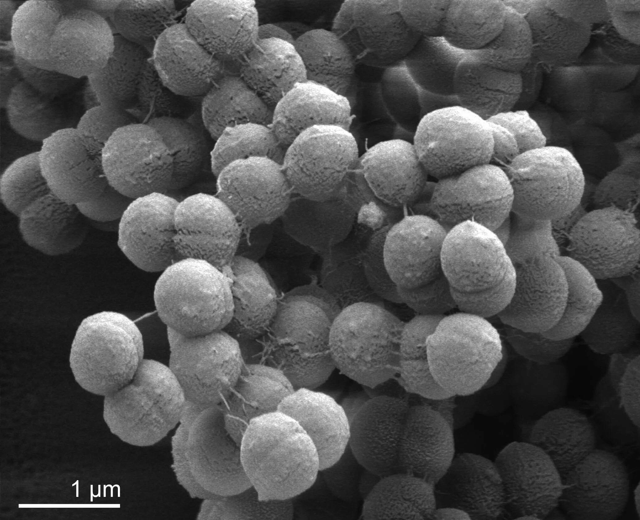 Anaerococcus spp