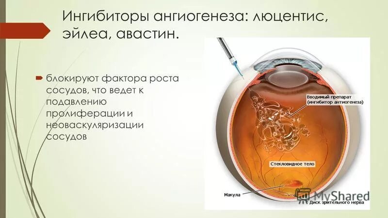 ингибиторы ангиогенеза