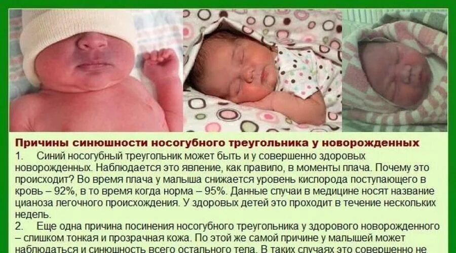 Синюшностью носогубного треугольника. Цианоз носогубного треугольника у новорожденных. У ребенка синеет носогубный. У новорожденного синеет носогубный треугольник.