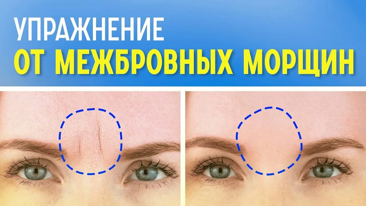 Какой прической скрыть межбровную складку goji موثوق Mawto9 in 2021 Beauty full girl, Beauty full, Beauty