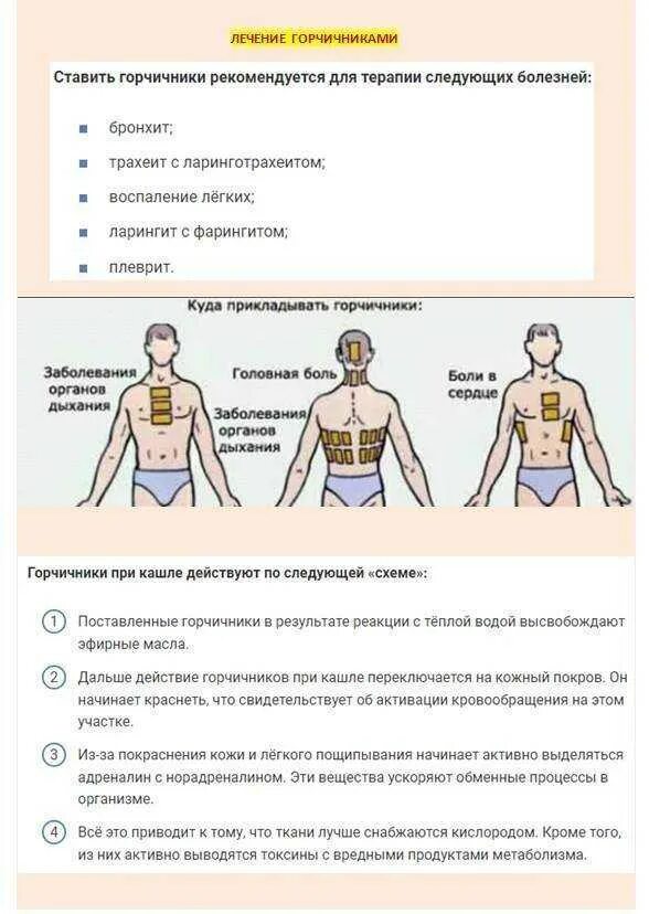 Можно ли греть грелкой при кашле. Места постановки горчичников при кашле. как надо правильно ставить горчичники при кашле. место постановки горчичников при бронхите и пневмонии. горчичники схема наложения.