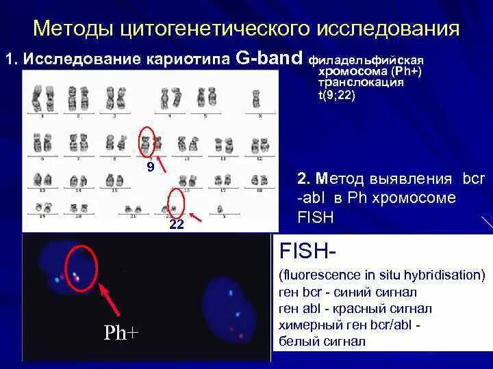 Какие методы используют для цитогенетического исследования. Цитогенетический метод исследования кариотипа. Цитогенетические исследования кариотип. Показания для цитогенетического исследования кариотипа. Цитогенетический метод изучения кариотипа.