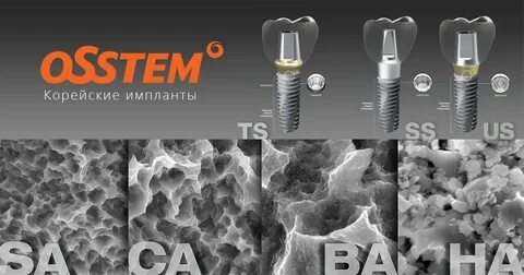 Имплант отзывы екатеринбург