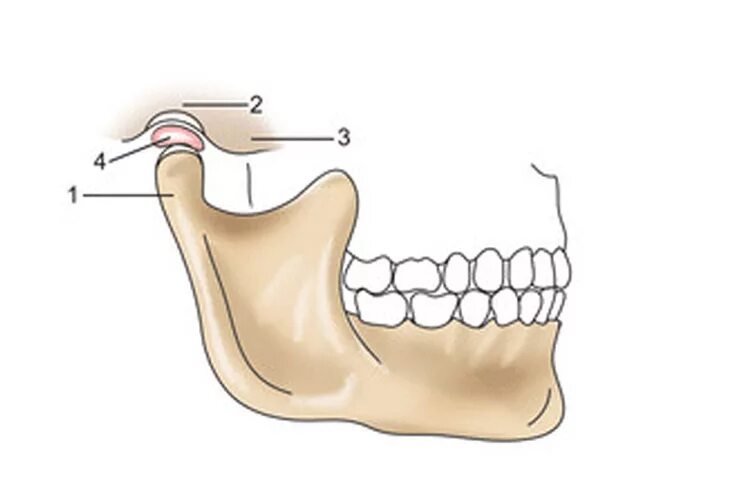 Анатомия сустава ВНЧС. Нижнечелюстная ямка ВНЧС. ВНЧС суставная головка нижней челюсти. Мыщелок челюсти