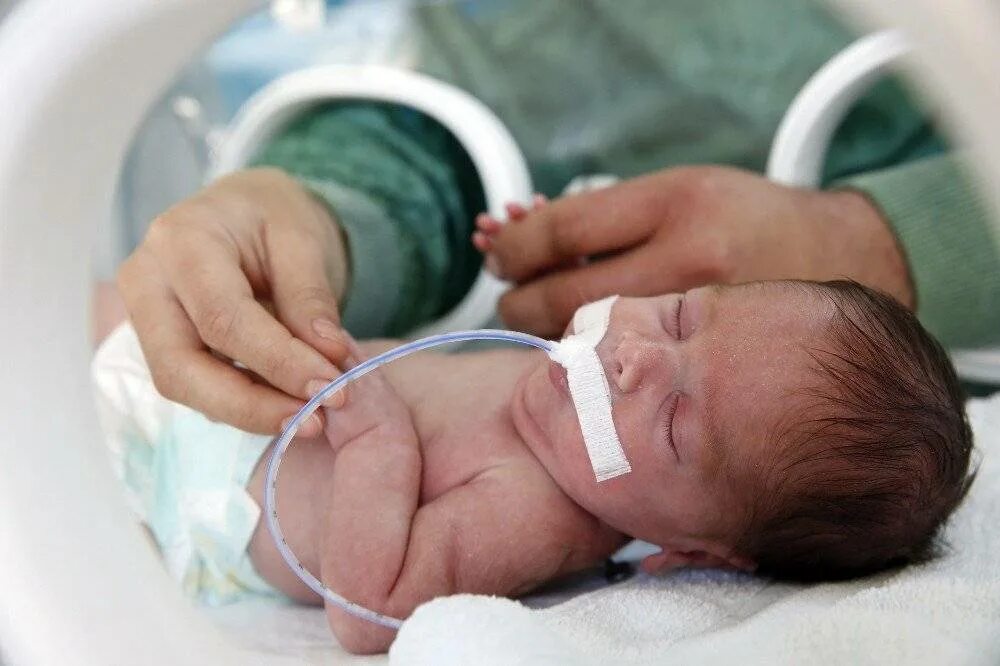 Опн новорожденных. Перинатальная постгипоксическая энцефалопатия. Перинатальная энцефалопатия у новорожденных. Асфиксия новорожденных. Что такое гипоксия у новорожденного ребенка.