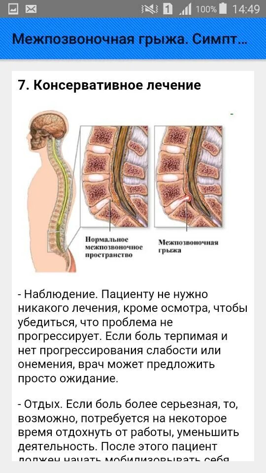 Симптомы межпозвоночной грыжи. Межпозвоночная грыжа симптомы. Позвоночная грыжа симптомы. Грыжа позвоночника симптомы.