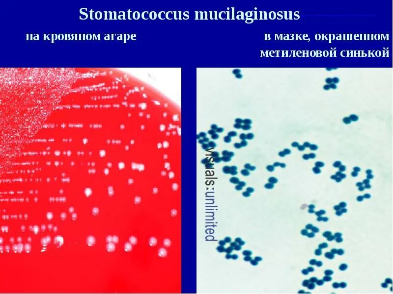 Staphylococcus в мазке у женщин