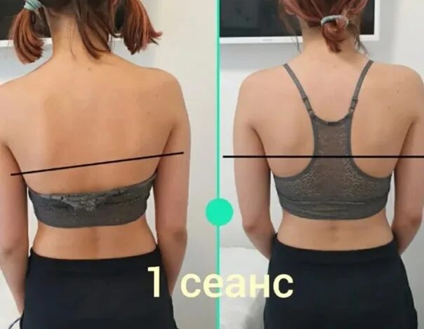 Мануальная терапия. Массаж лица. Хиропрактика позвоночника. Остеопластика массаж что это. Остеопластика массаж что это.