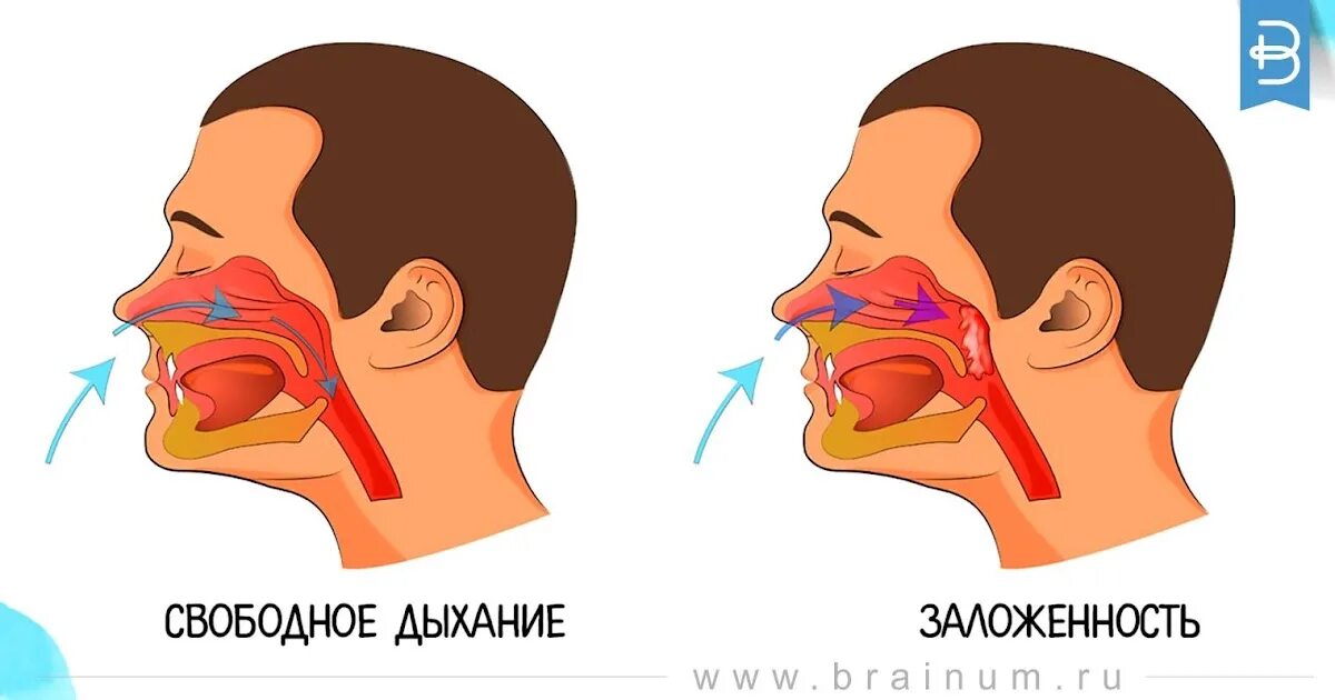 Сильно заложило