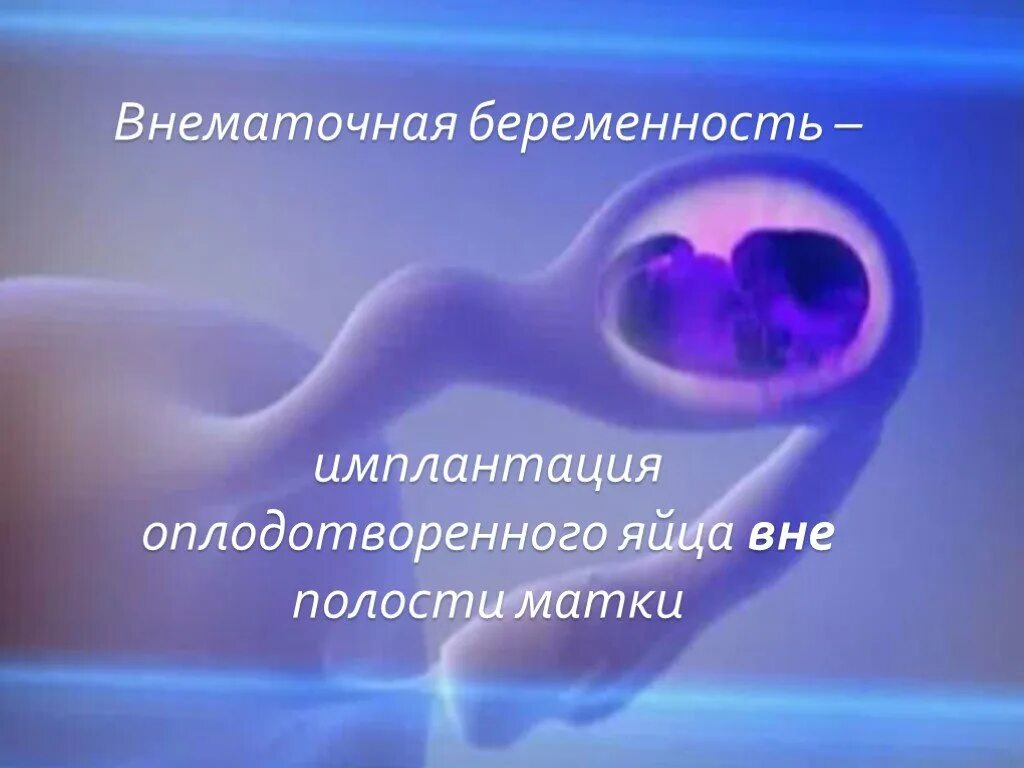 Внематочная трубная беременность узи. Внематочная эмбриона беременность. Внематочная трубная беременность узи. Внематочная беременность в маточной трубе. Внематочная беременность на узи.