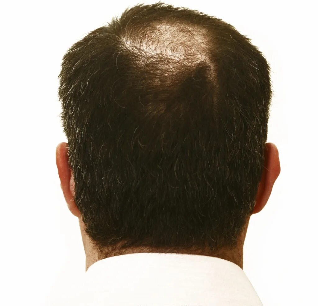 болит в висках причины. головные боли в голове. печет затылок головы. локализация глазной боли. боль в голове.