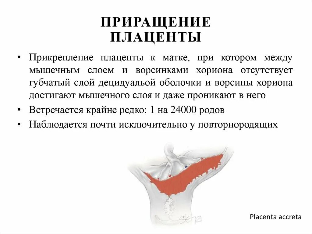 Истинное приращение. Аномальное прикрепление плаценты. Приращение плаценты этиология. Патологическое прикрепление плаценты.