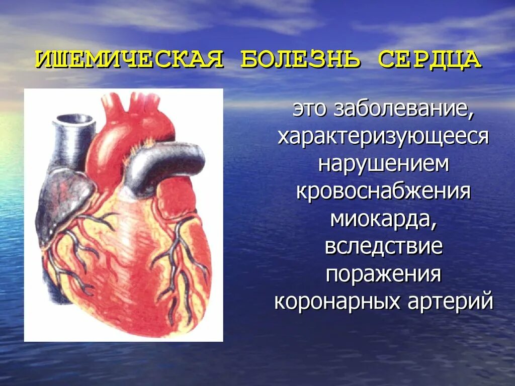 Легкие сердечные заболевания. Ишемическая болезнь сердца. Ишемические поражения сердца.