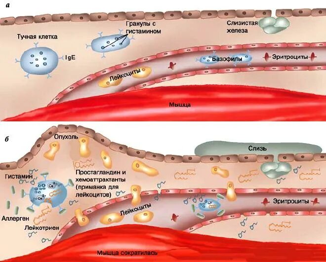 Отечность клеток. Гистамин из тучных клеток. Аллергия на клеточном уровне. Высвобождение гистамина из тучных клеток. Тучные клетки и аллергия.