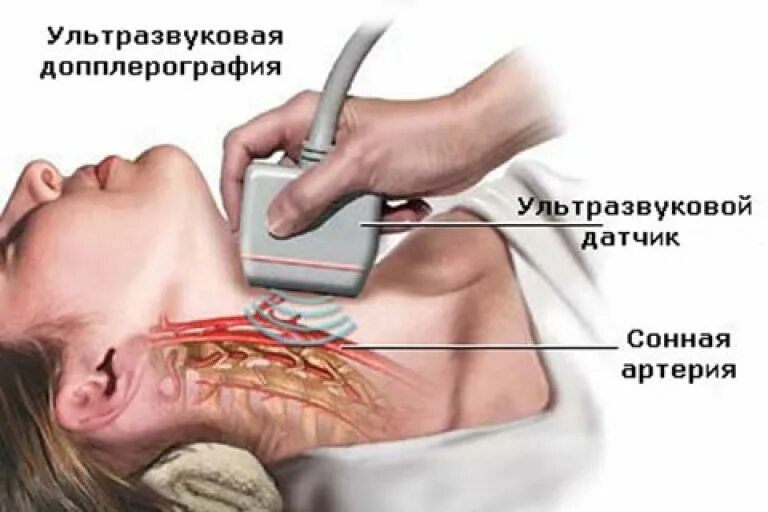 Как делают узи сосудов головы и шеи. Как делают узи сосудов головы и шеи