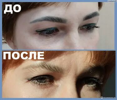 На бровях и я
