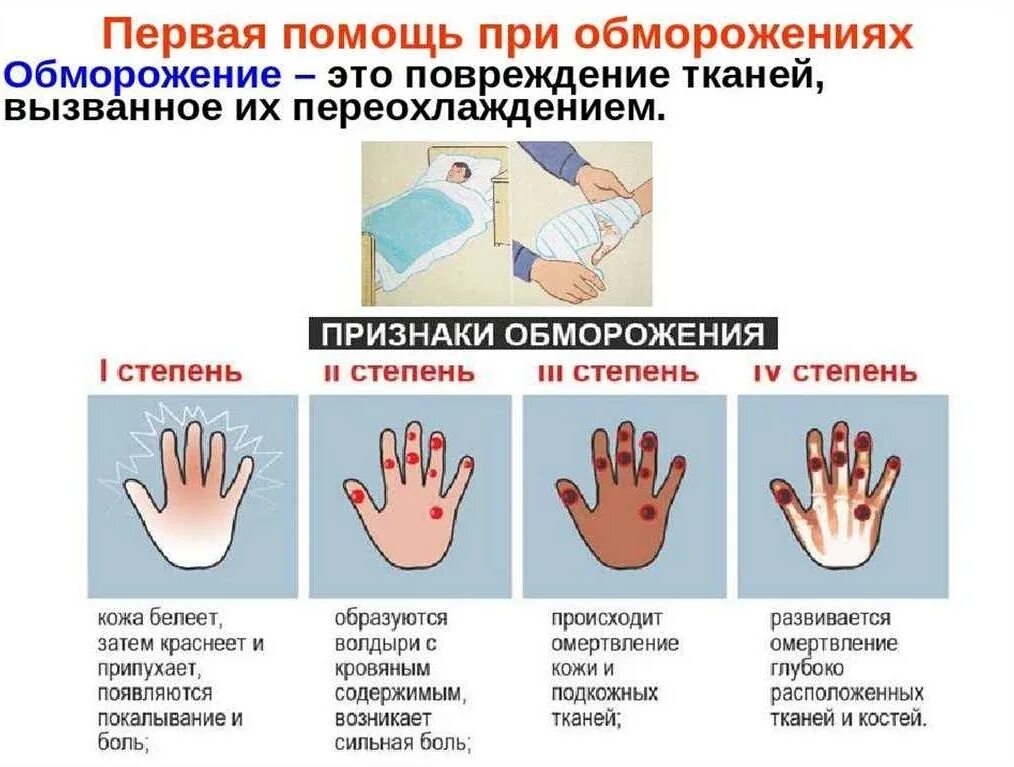 Обморожение признаки и первая помощь. 1 степень обморожения пмп. первая помощь при 1 стадии обморожения. степени отморожений 1 степень. 1 степень обморожения характеризуется.