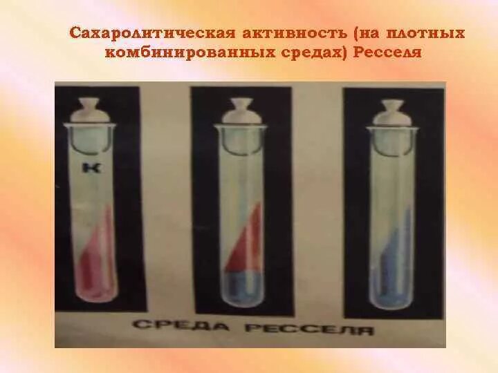 Среда разложения. Среда ресселя микробиология. посев на среду ресселя. принцип работы со средой ресселя. среда ресселя состав.