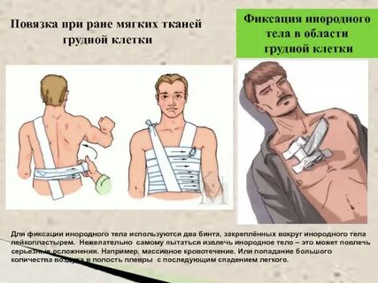 Повязки при проникающих ранениях
