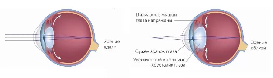 Как работает хрусталик глаза. Аккомодация цилиарная мышца. строение цилиарной мышцы глаза. спазм аккомодации глаз. механизм аккомодации хрусталика.