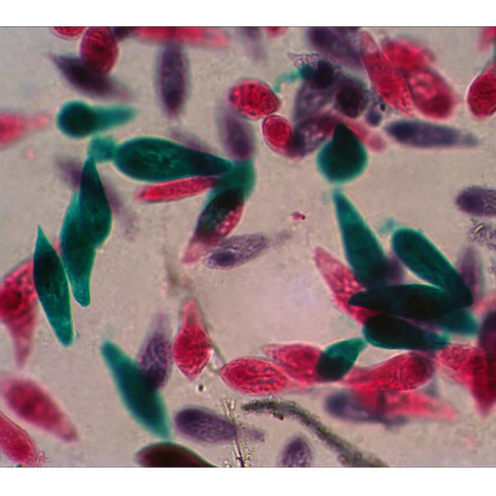 Снимки из микроскопа. Что можно рассмотреть в микроскоп. Клетка через микроскоп. Клетки кожицы лука в микроскопе. Аксессуары levenhuk n38 ng.