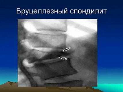 Переднее продольное