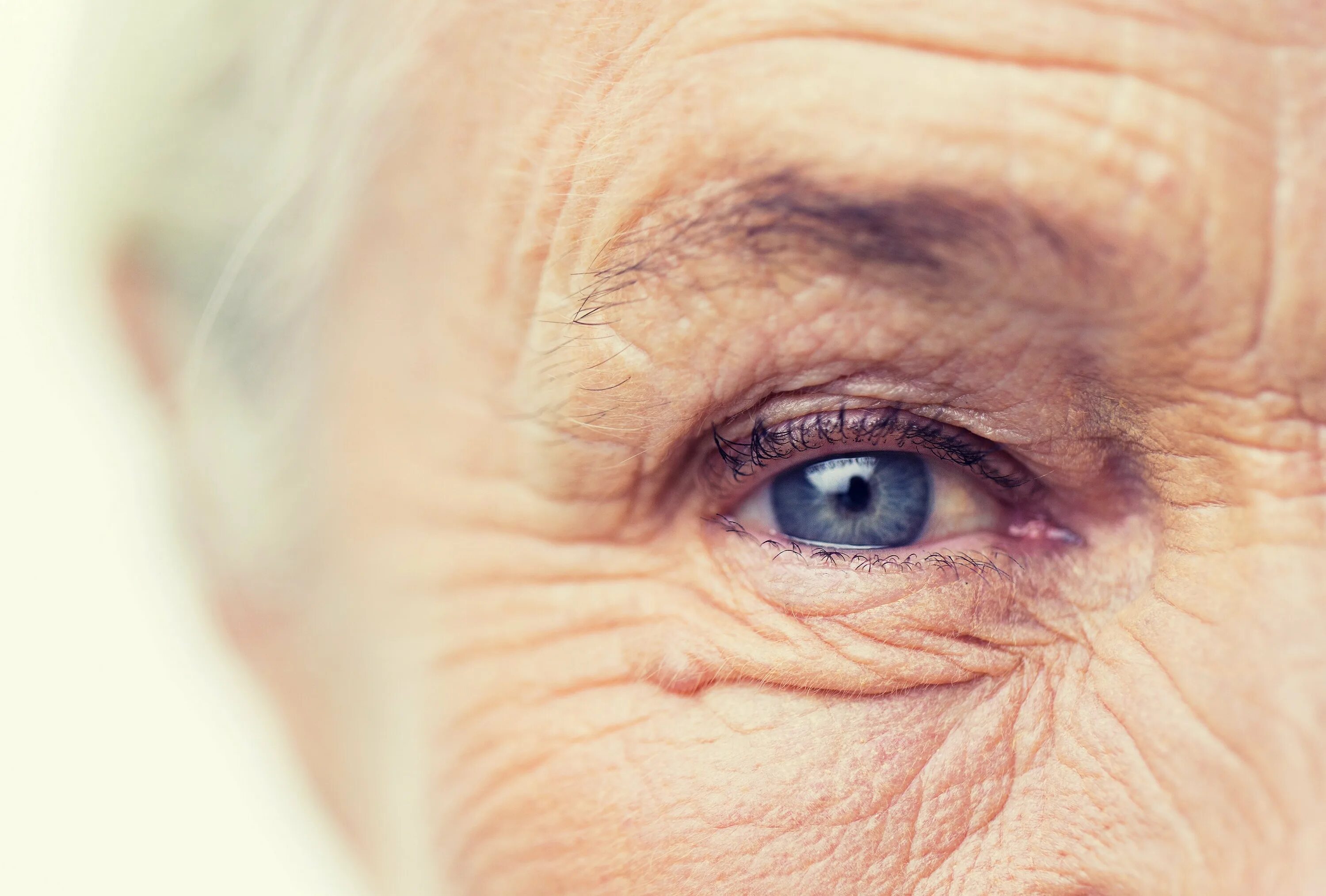 Старческая ядерная катаракта. Сенильная катаракта глаза. Глаза пожилого человека.