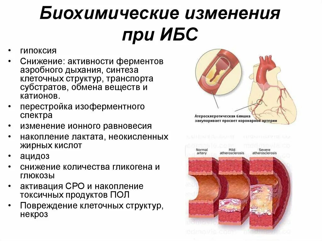 Биохимические изменения при ИБС. Биохимические изменения в мышцах при патологии. Ишемия миокарда биохимия.