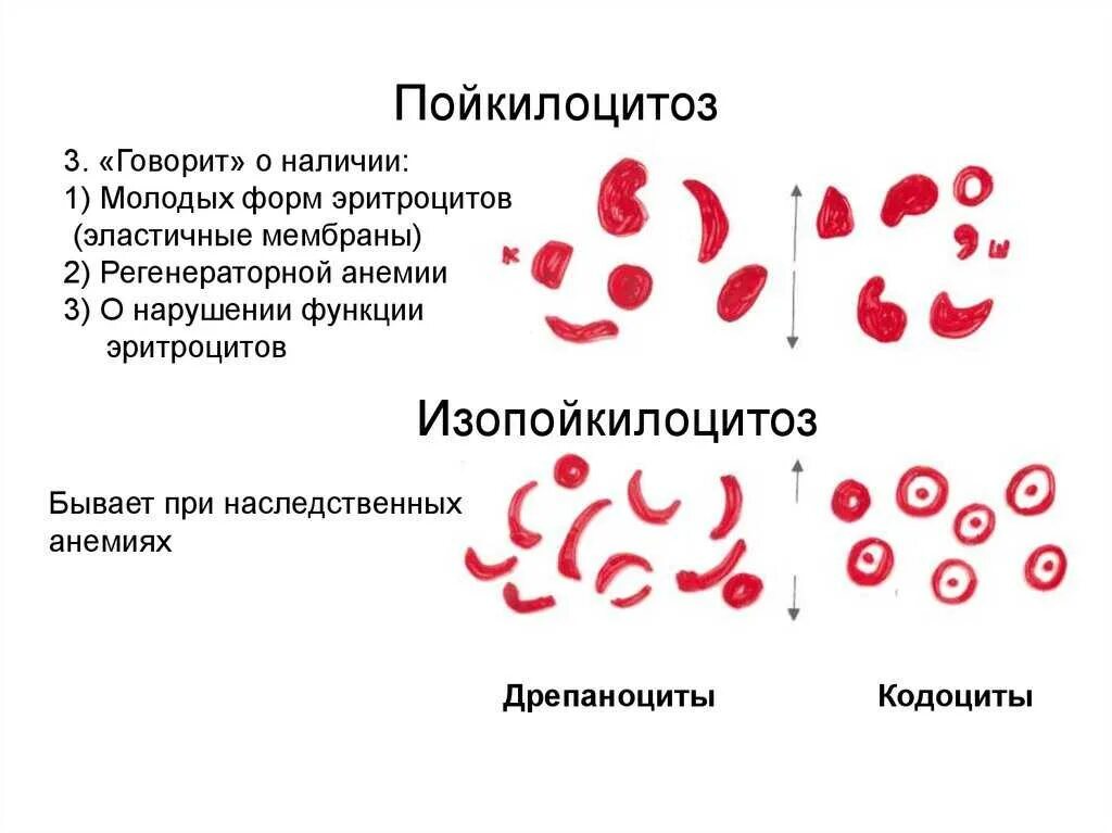 Пойкилоцитоз что это такое. Пойкилоцитоз причины. Пойкилоцитоз что это такое. Анизоцитоз и пойкилоцитоз в общем анализе. Пойкилоцитоз наблюдается при.