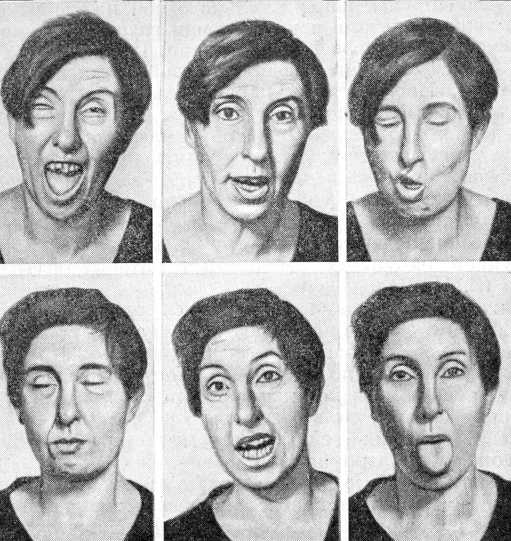 Харер нама харер нама харер намаива кевалам перевод. Харер нама эва кевалам. Малая хорея гиперкинезы. Павел хареев челябинск. Болезнь гентингтона.