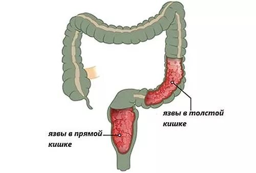 Хирург прямая кишка