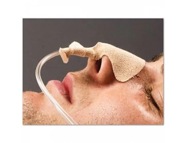 промывание желудочного зонда алгоритм. зонд для дуоденальное зондирование. питание через назогастральный зонд. зонт через нос. зонд для питания больных через нос.