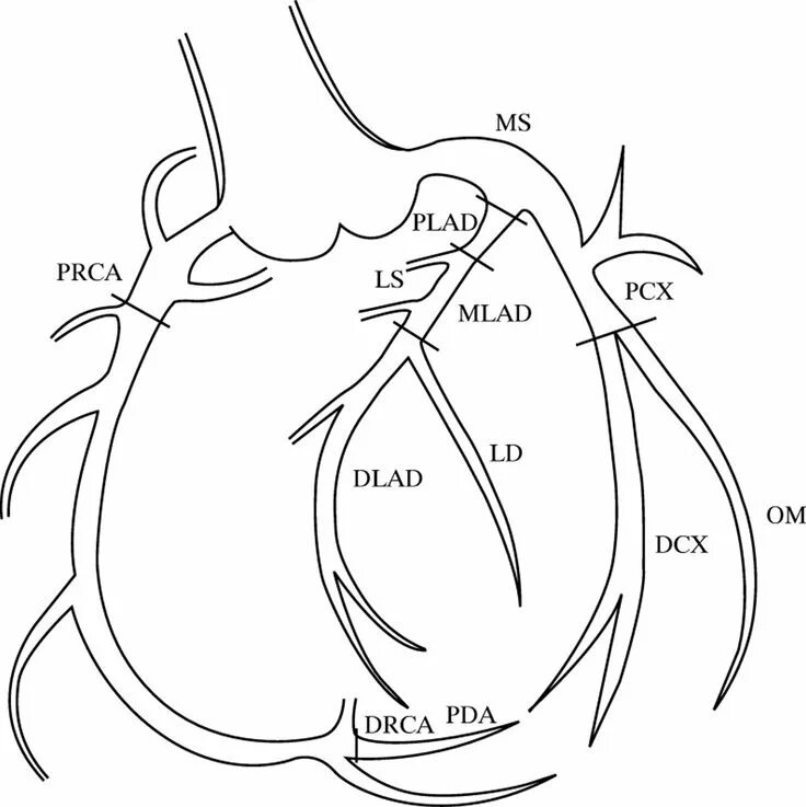 Коронарные артерии сердца схема. Левая коронарная артерия анатомия. Ствол левой коронарной артерии анатомия. Схема левой коронарной артерии.