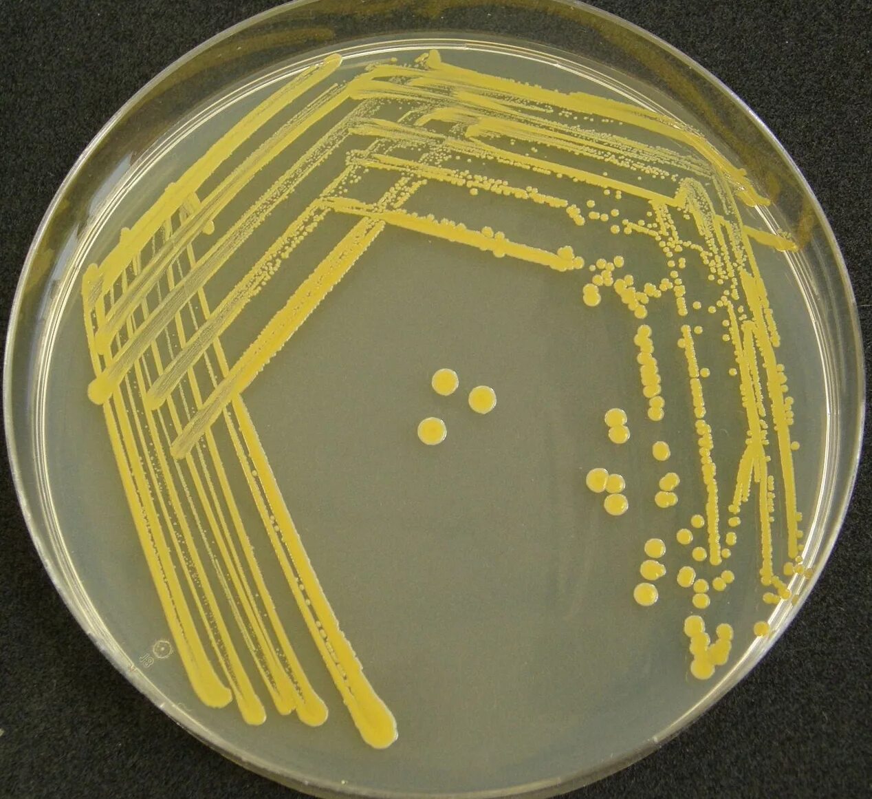 Стафилакока. S. aureus золотистый стафилококк. Золотистый стафилококк на ЖСА. Стафилококк золотистый Staphylococcus aureus. Стафилококк ауреус в чашке Петри.