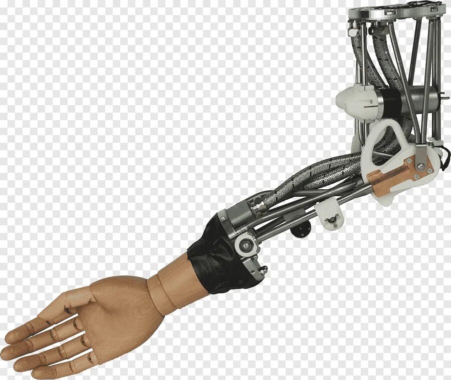 Arm engineering. Otto bock протезы кисти. bionic prosthesis arm. рука робота. механические протезы.