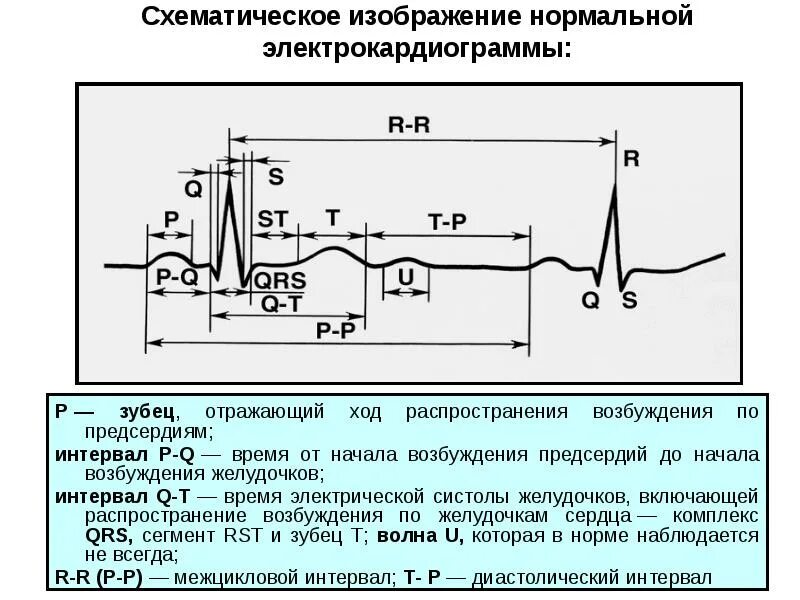 Элементы нормальной экг. Зубец отражает возбуждение. Зубец отражает возбуждение. Зубец отражает возбуждение. Зубец р отражает возбуждение.
