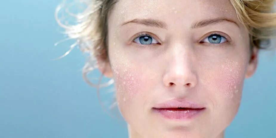 Чувствительная кожа лица. Самую сухую кожу. Сухая кожа. Самую сухую кожу. Самую сухую кожу.