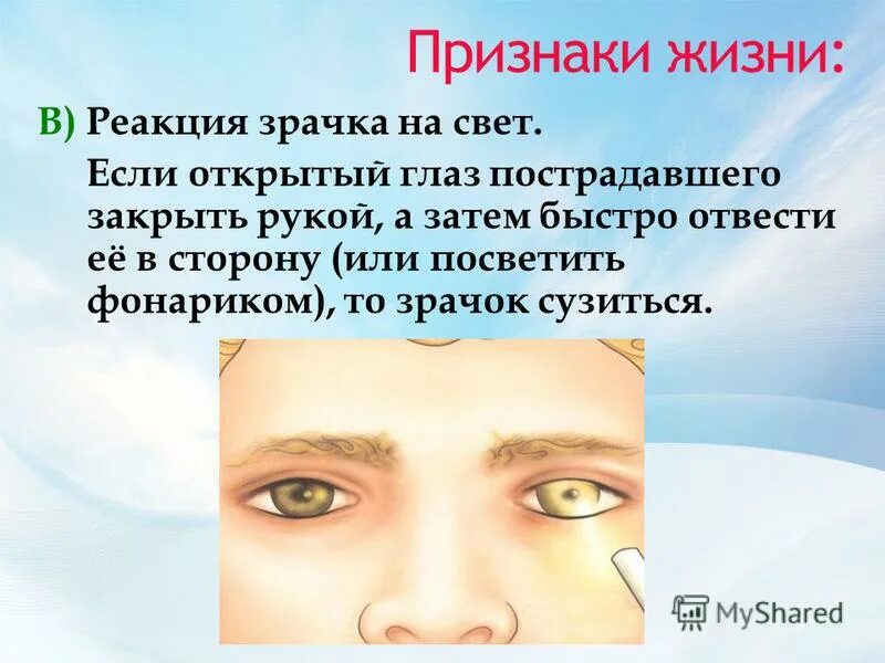 Зрачок реагирует на свет. Проверка реакции зрачков на свет. Отсутствие реакции зрачка на свет признак отсутствия